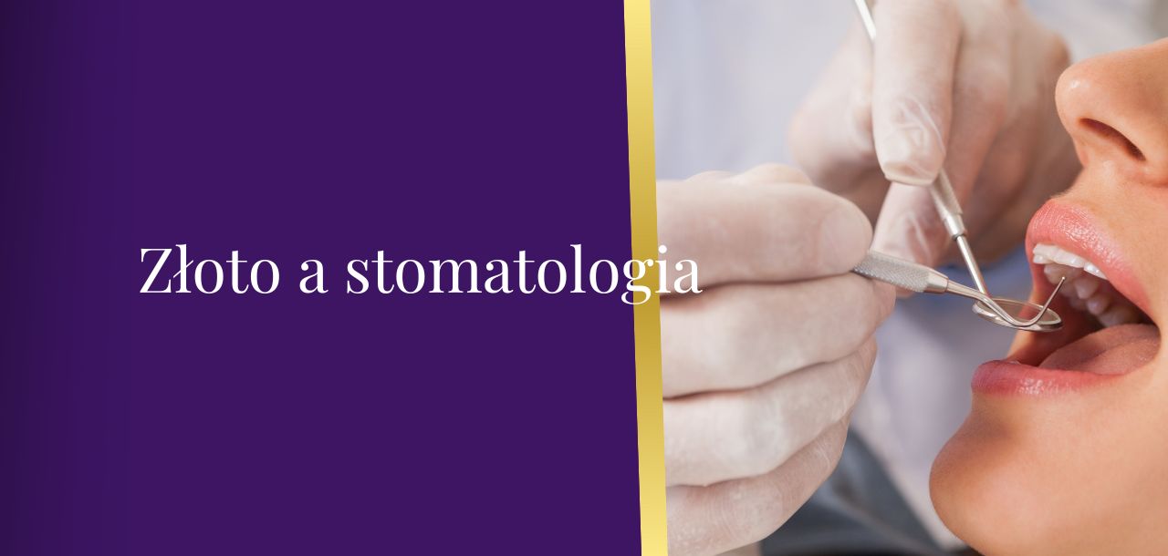 Złoto a stomatologia grafika 